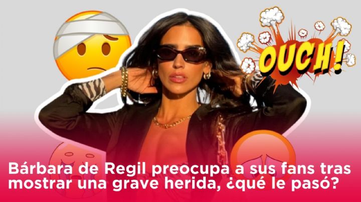 Bárbara de Regil preocupa a sus fans tras mostrar una grave herida, ¿qué le pasó?
