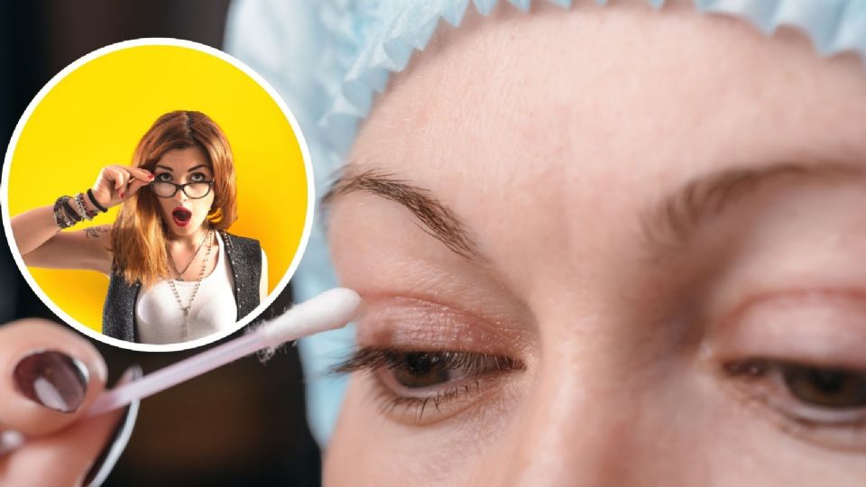 Así podrás recuperarte del parpado caído.