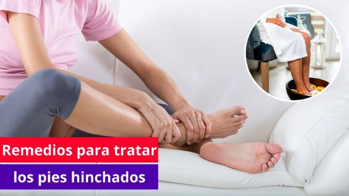 ¿Qué hacer cuando se tiene los pies hinchados? Mejores remedios caseros para desinflamar