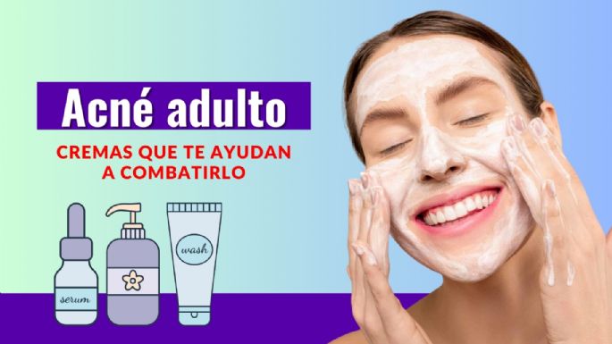 Acné adulto: Cremas que te ayudan a luchar contra estas imperfecciones