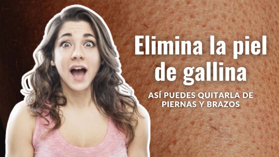 Cómo eliminar la piel de gallina.