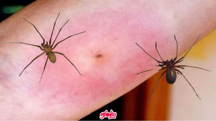 ¿Qué tan peligrosa es la araña violinista y qué hacer si te pica una?	