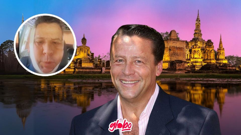 Alfredo Adame sorprendió a sus seguidores con el rostro vendado.