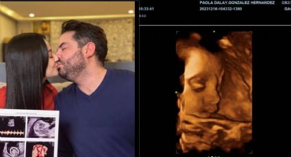 ¿Igualito a Eugenio Derbez? José Eduardo comparte primera imagen de su bebé