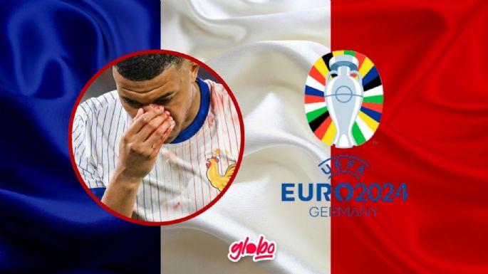 Así fue la fractura de Kylian Mbappé tras el Austria vs. Francia en la Euro 2024