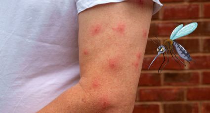 ¿Por qué los mosquitos pican más a unas personas que a otras? Esto es lo que los atrae