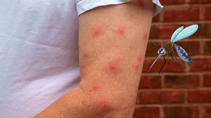 ¿Por qué los mosquitos pican más a unas personas que a otras? Esto es lo que los atrae