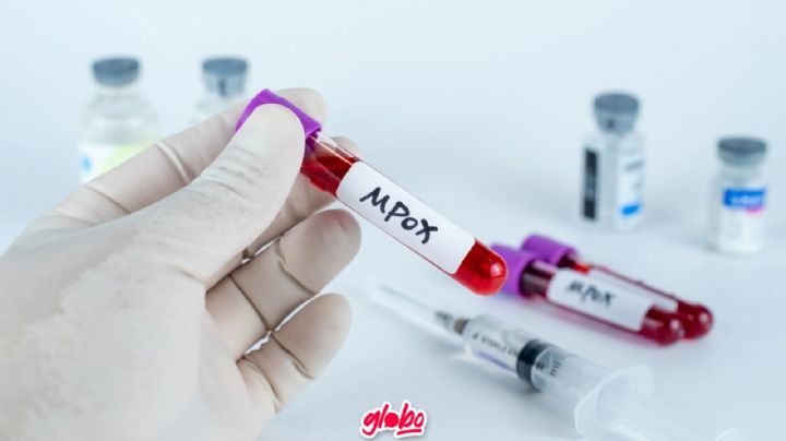 Mpox: ¿Qué es y cómo se contagia? Estos son los SÍNTOMAS de la antes llamada Viruela del Mono