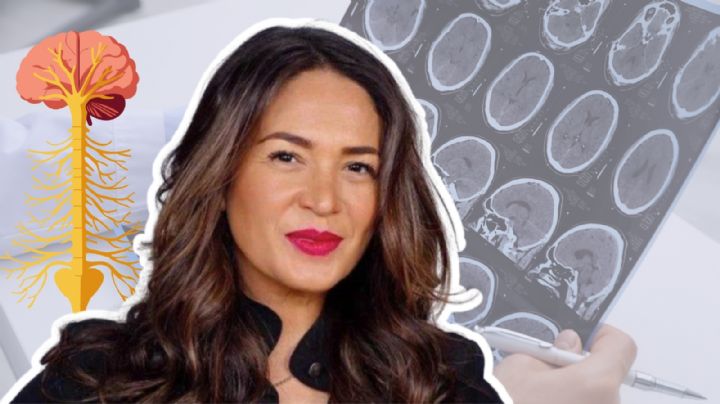 ¿Qué es la esclerosis múltiple, supuesta enfermedad que tiene Yolanda Andrade?