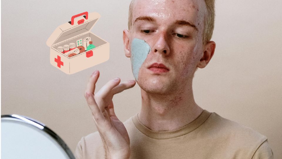 Tratamientos contra el acné.